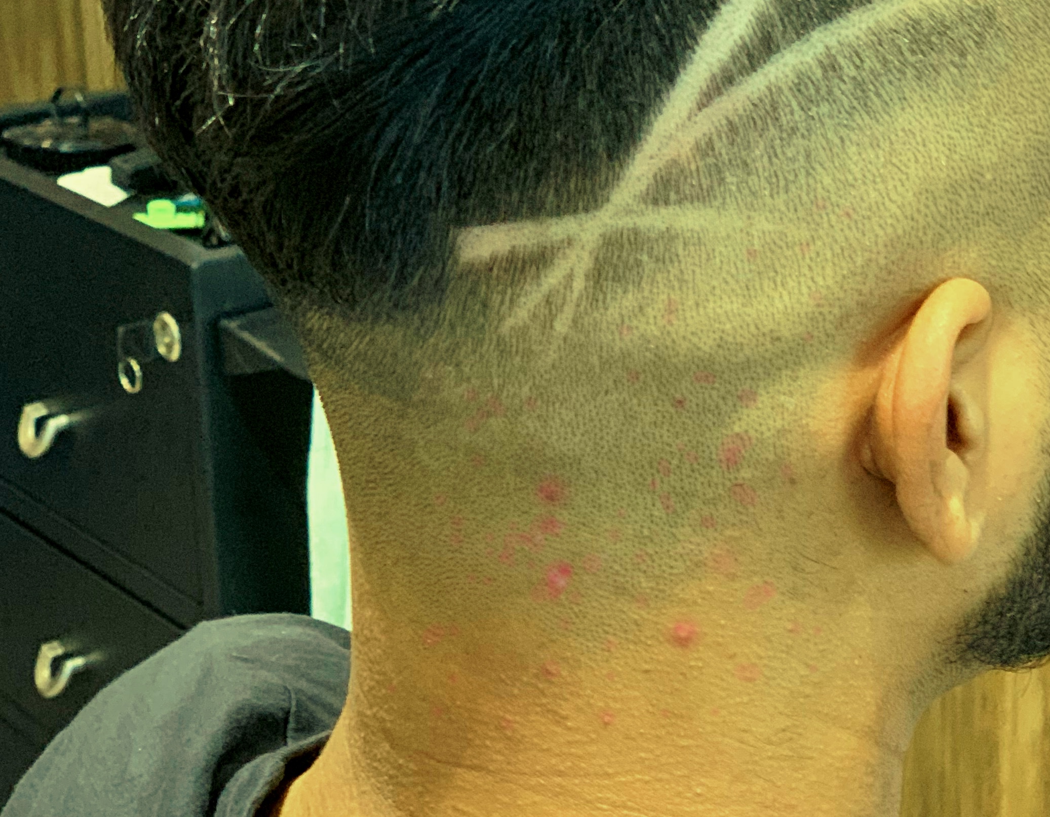 A skin fade haircut